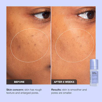 iNNBEAUTY PROJECT Pore Refine Pore Shrinking & Texture Smoothing Serum *pre-order*