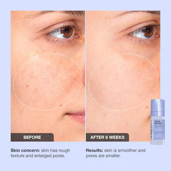 iNNBEAUTY PROJECT Pore Refine Pore Shrinking & Texture Smoothing Serum *pre-order*