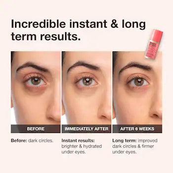 iNNBEAUTY PROJECT Bright & Tight Dark Circle Firming Eye Cream with Vitamin C & Peptides