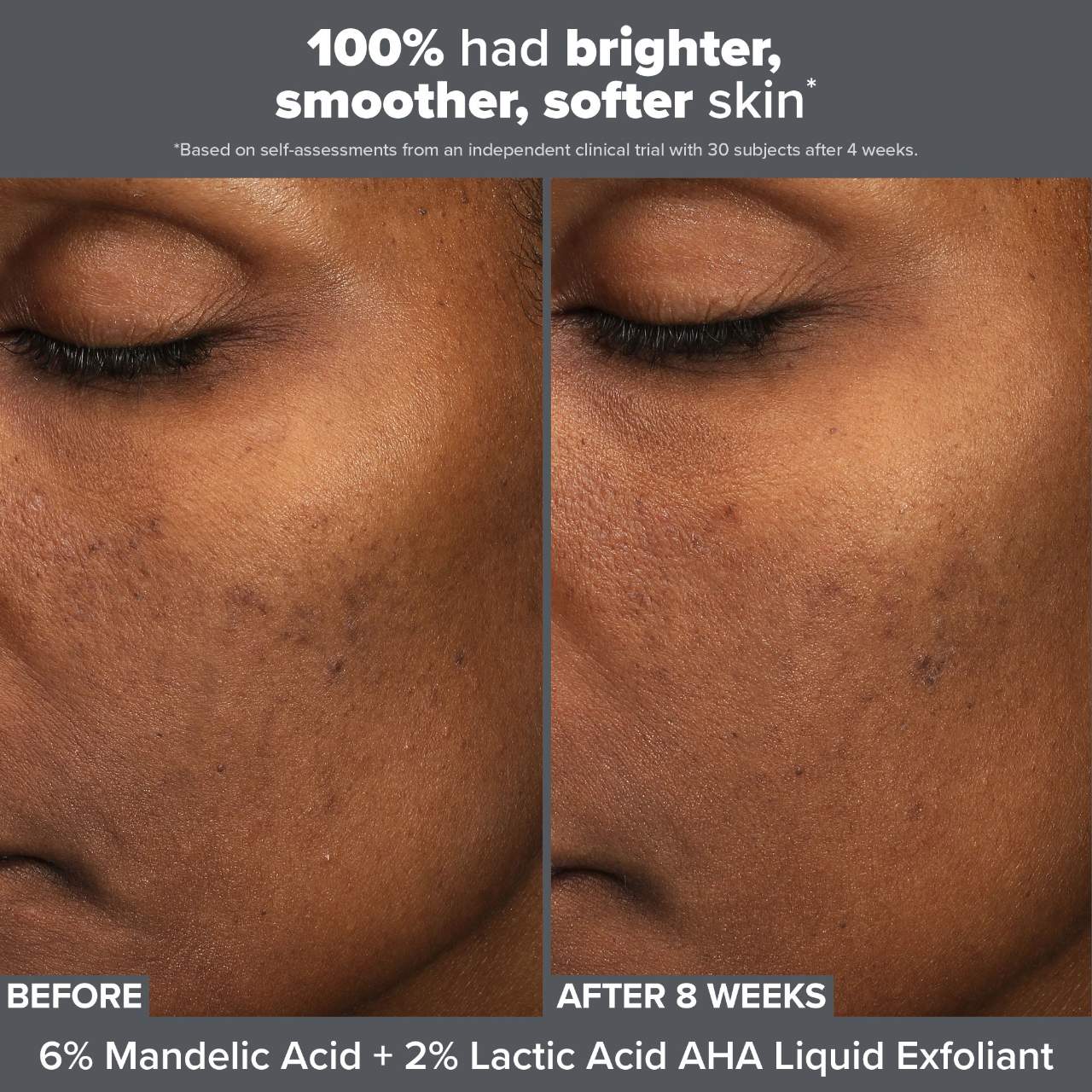 Paula's Choice Smooth & Glow Exfoliating Duo for Clear and Brighter looking skin *PRE-ORDER*